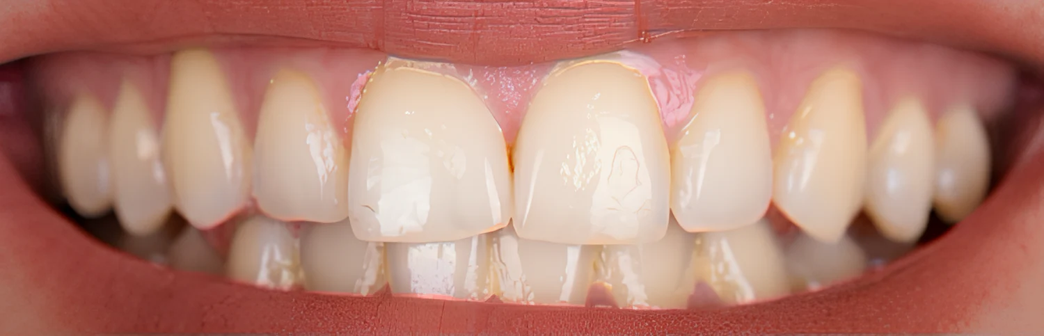 Sourire avant l’utilisation du dentifrice White Smile